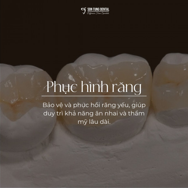 PHỤC HÌNH RĂNG