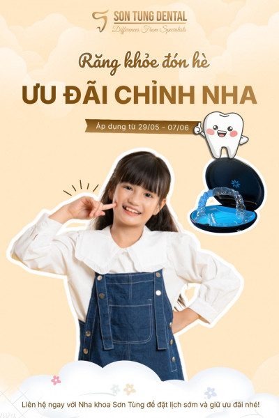 CHÀO 1/6 CÙNG NHA KHOA SƠN TÙNG – ƯU ĐÃI CHỈNH NHA DÀNH RIÊNG CHO CÁC “THIÊN THẦN NHÍ”