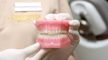 Niềng răng có cần nhổ răng không