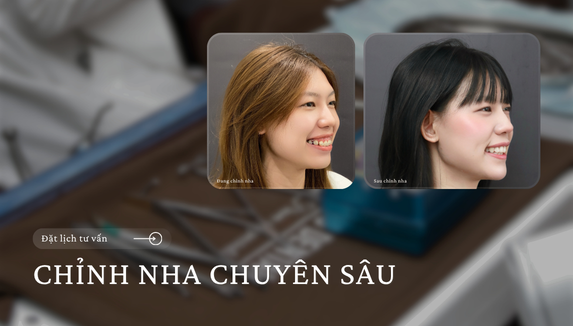 dịch vụ 2