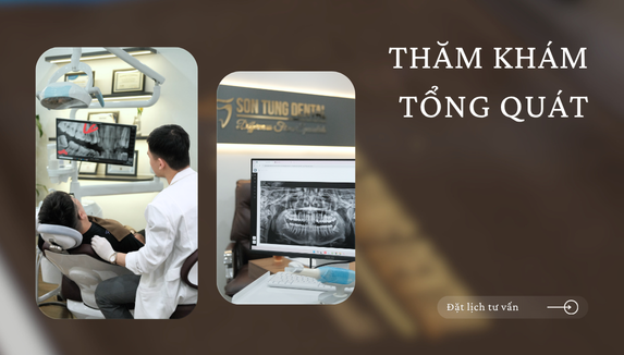 Dịch vụ 4