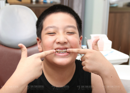 Nieng rang som o tre
