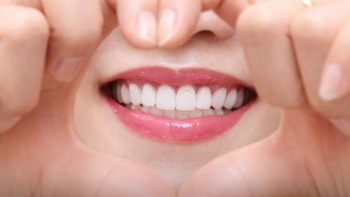 CHI PHÍ BỌC RĂNG SỨ